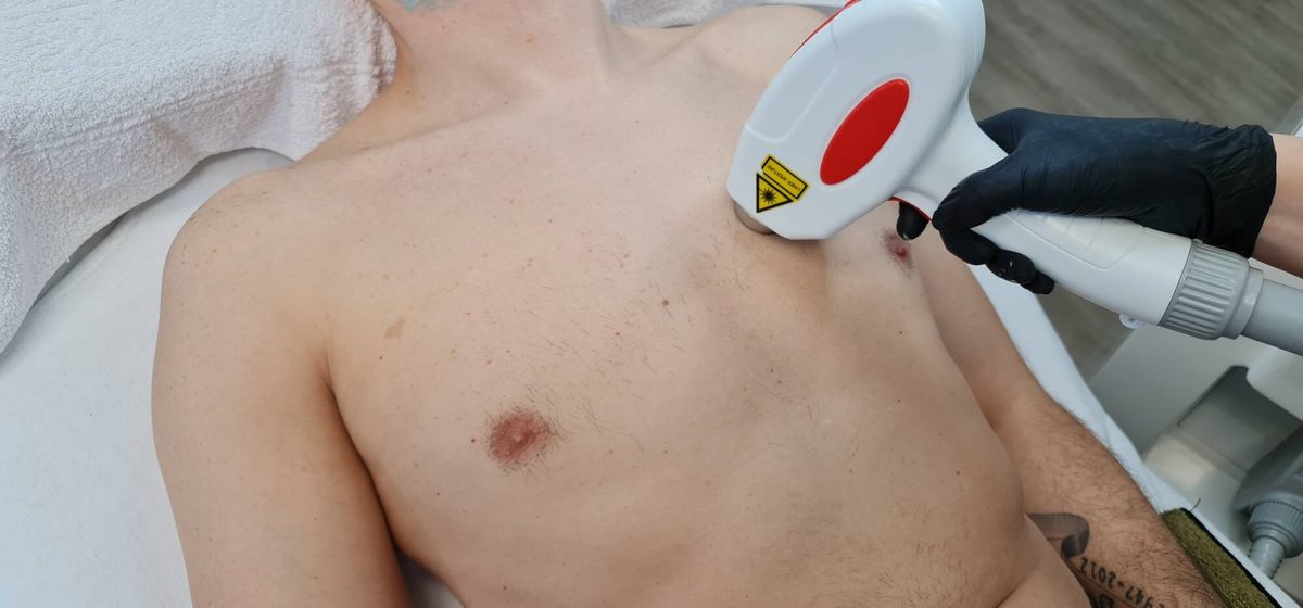 Diodenlaser &ndash; Beispiel