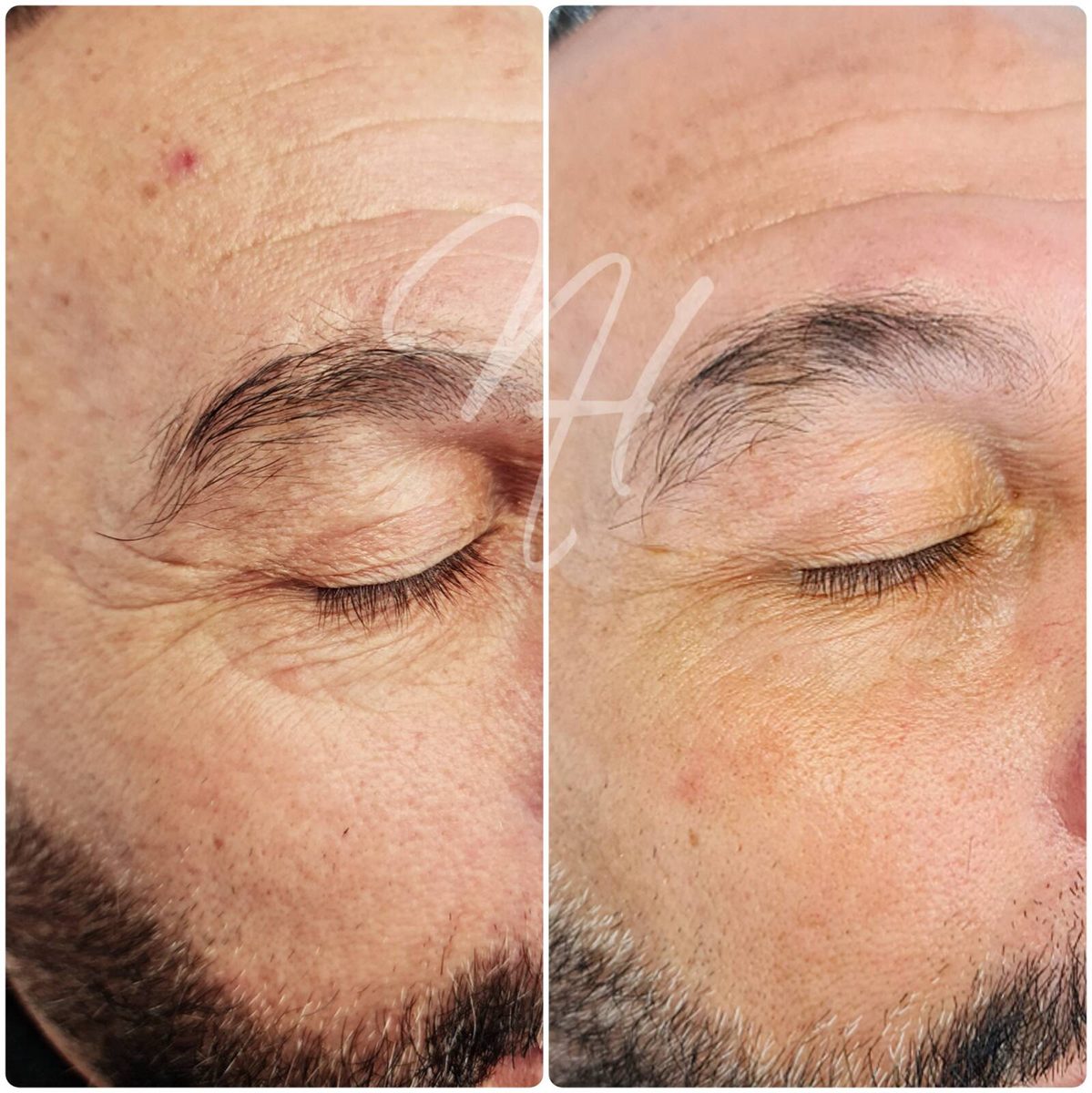 Männerkosmetik &ndash; Beispiel