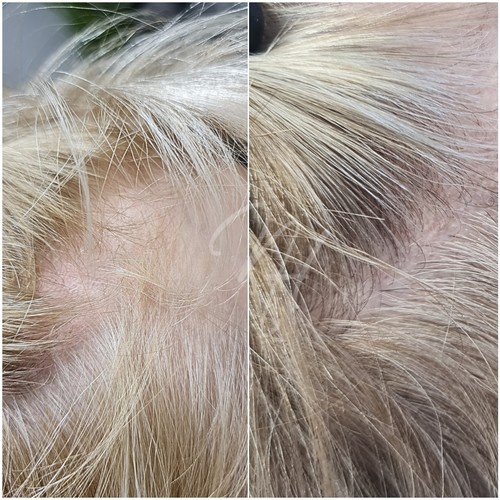 Vorher Nachher — Kopfhaut & Haare (5/5)