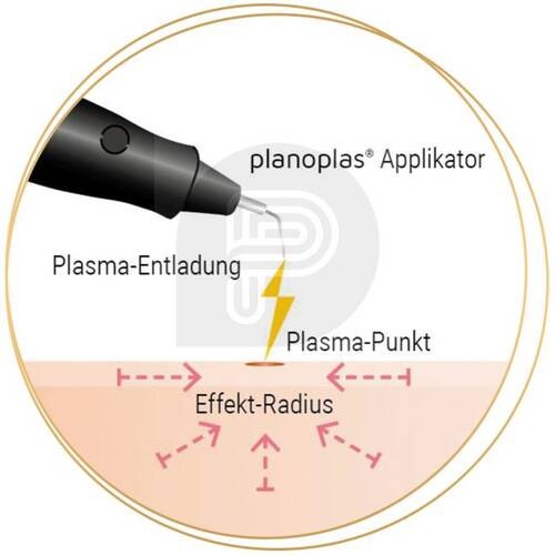 Behandlungsmethode mit PlasmaPen