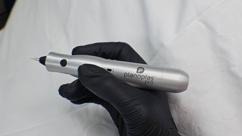Plasma Pen (penna a ioni)