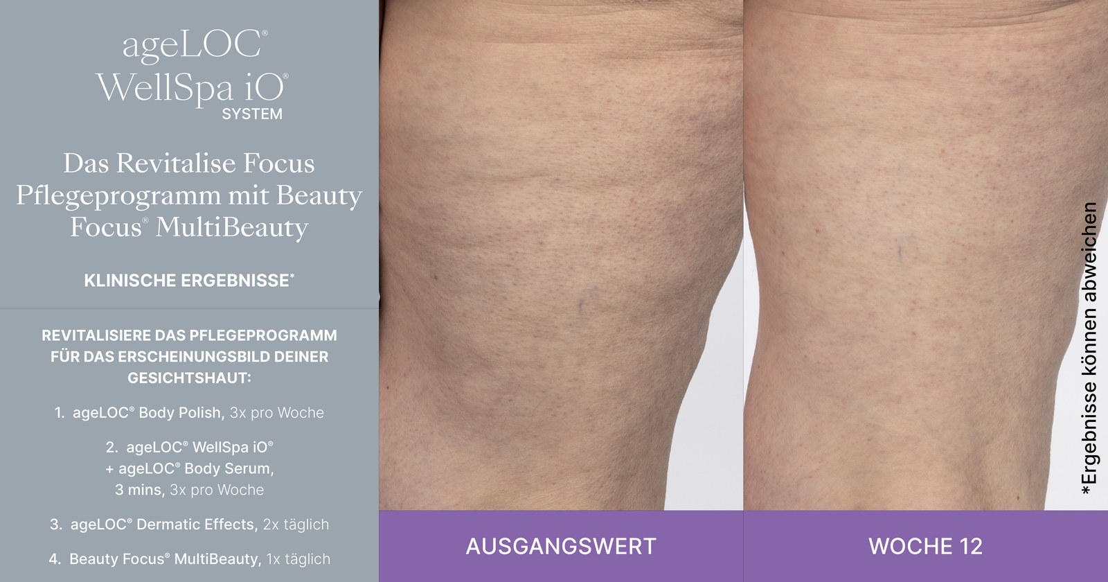 Klinisches Ergebnis – Vorher/Nachher