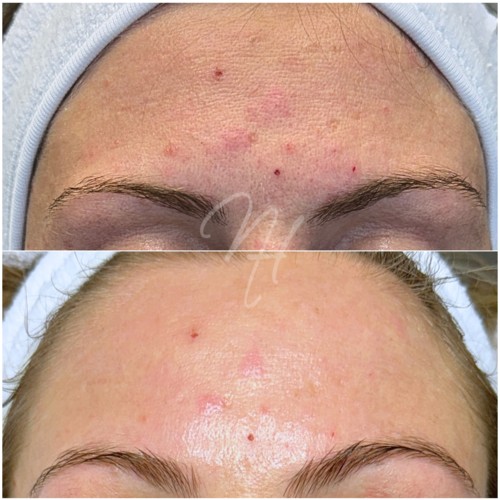 Premium und De Luxe Gesichtsbehandlung Trier