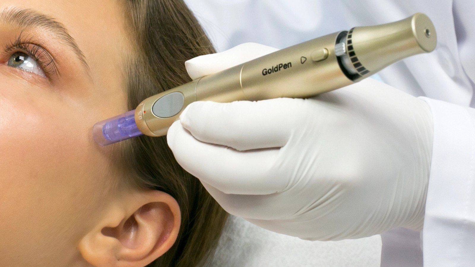 DERMICA GoldPen in Anwendung – ExoPDRN bei Art of Beauty Trier