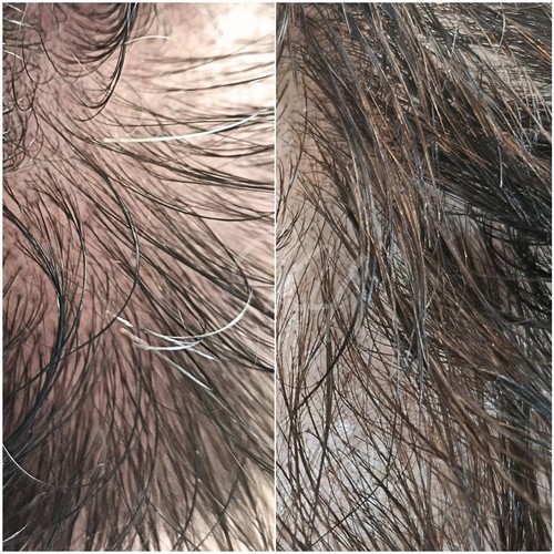 Vorher Nachher — Kopfhaut & Haare (4/5)