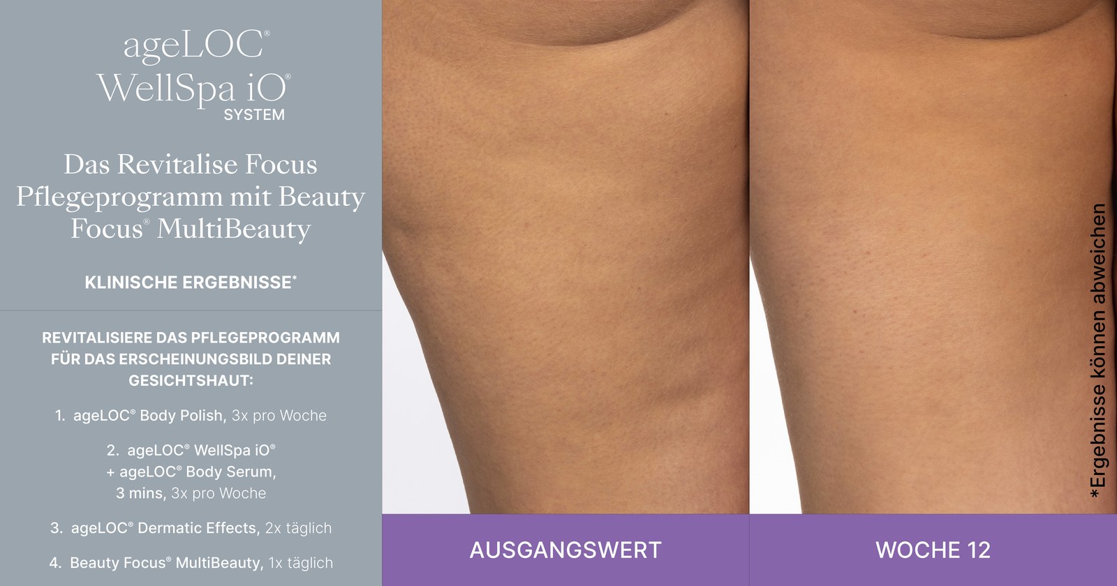 Klinisches Ergebnis – Vorher/Nachher