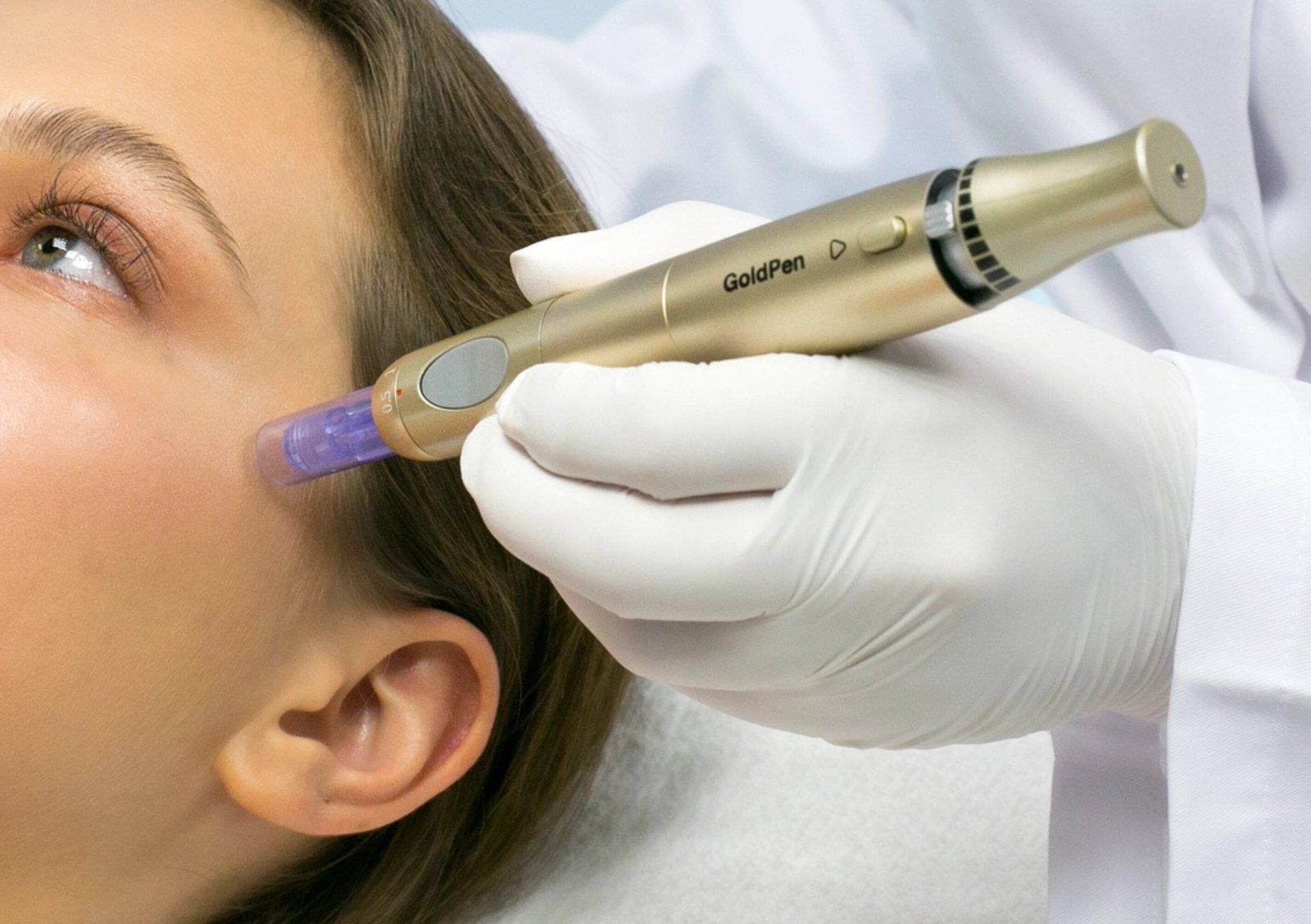 ExoPDRN mit dem DERMICA GoldPen ins Gesicht eingeschleust – Art of Beauty Trier